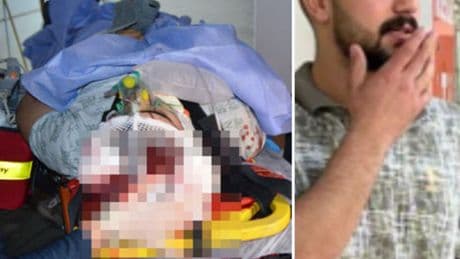 Annesi, kardeşi ve komşusunu vurdu! Acı haber geldi!