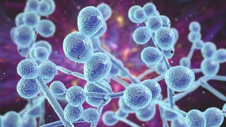 Candida auris: Killer fungus warning as 'global threat' already detected in UK