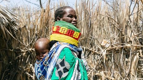 UK aid cuts will decimate the fight against malnutrition – leaving millions at risk across Africa