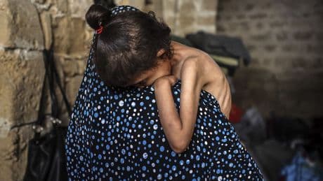 De hongersnood in Gaza treft vooral kinderen