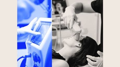 Skin tightening is getting more advanced &mdash; and less painful. Here are the new techniques replacing facelifts.