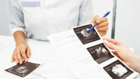 “Solo el control ecográfico puede frenar a tiempo el cáncer ginecológico más letal”