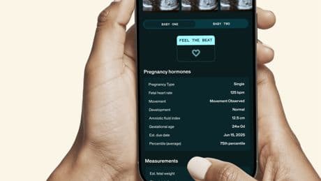 ‘Incredibly moving’ app lets you feel your unborn baby’s heartbeat through your phone