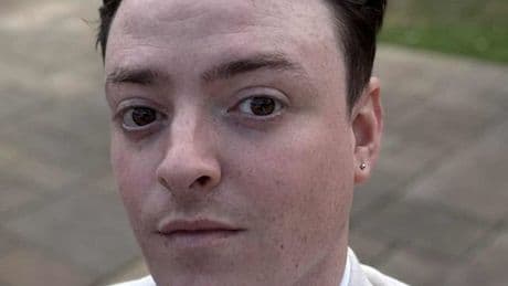 Tourist's horror condition after bite from Australian spider that reached UK