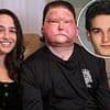 Car crash victim, 26, who received face transplant from 47-year-old man reveals what he heard while in a coma