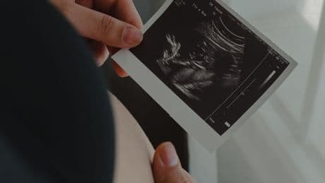 Crean el primer modelo artificial de saco amniótico humano