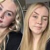 Woman, 21, forced to 'glue eyelids open' just so she can see due to rare condition - but doctors say there's no cure