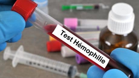 Journée mondiale de l’hémophilie : les symptômes féminins toujours mal reconnus
