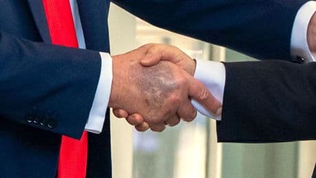 Trump erneut mit Bluterguss an der Hand fotografiert