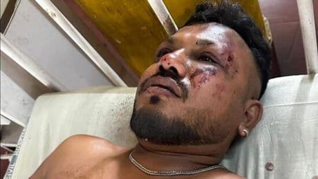 Extraordinary new video shows moment miracle Air India survivor stumbles from crash
