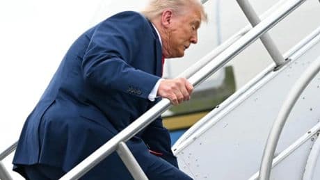 Qué es la insuficiencia venosa crónica que padece Donald Trump: una dolencia varicosa infrecuente en hombres
