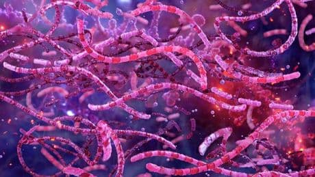 Anthrax outbreak sparks cross-border alert in African country near wildlife park