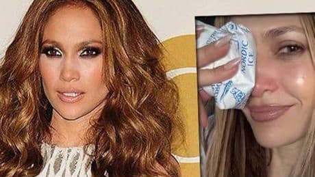 Jennifer Lopez Amerikan Müzik Ödülleri provasında yaralandı! İşte son sağlık durumu