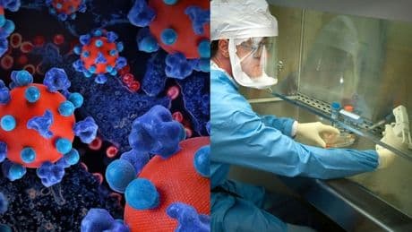 Hiv, l'Oms raccomanda nuovo farmaco: «Svolta storica. Con due dosi l'anno previene infezione»
