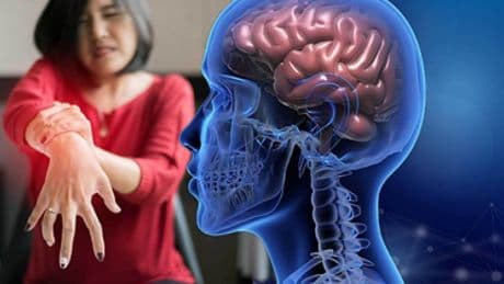 Hava kirliliği ve böcek ilaçları Parkinson riskini artırıyor