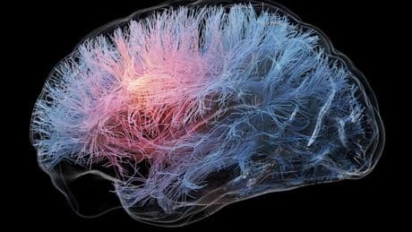 Forscher finden genetischen Schalter für Intelligenz im Gehirn