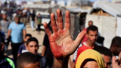 Un grupo de 25 países exige a Israel el alto el fuego «inmediato» en Gaza