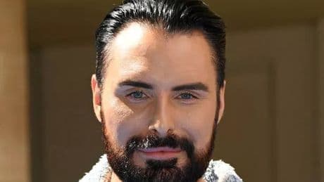 Rylan Clark's 'mugging' by surprise assailant leads to awkward call to police