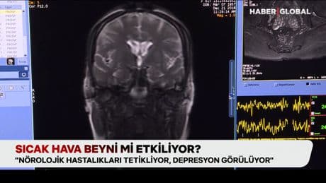 Sıcak hava beyni mi etkiliyor? "Nörolojik hastalıkları tetikliyor"