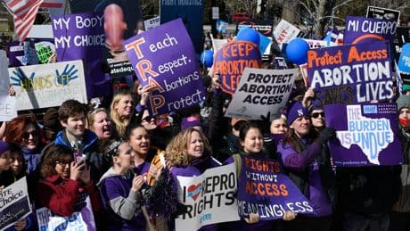 US abortion clinics are closing even in states where abortion is legal. More cuts could be coming