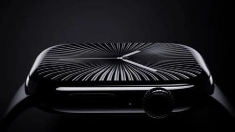 Apple Watch Series 11: lo que sabemos sobre el reloj inteligente que se presenta mañana en Cupertino