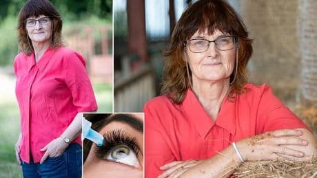 My dry eyes and gut symptoms were signs of a little-known disease that mainly strikes women - here's the test you should ask for to avoid years of suffering