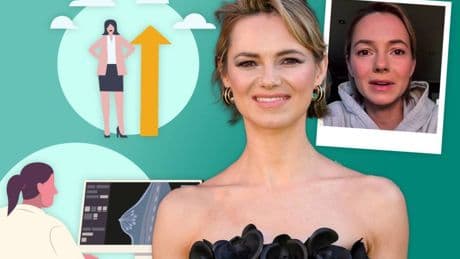 The 2 surprising factors that ‘increase your breast cancer risk’ as Kara Tointon reveals brave mastectomy