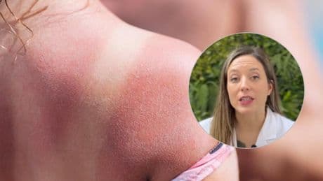 Paloma Borregón, dermatóloga: ''Los llamados 'tatuajes solares' son un riesgo porque las zonas que se queman las estamos exponiendo a una mutación del ADN''