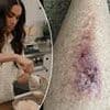 Woman who claims Meghan Markle's bath salts gave her 'catastrophic burns' threatens to sue the duchess for $10m