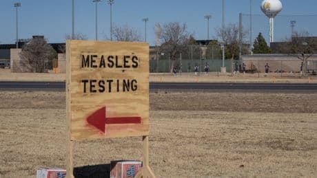 Measles cases spread to three more states