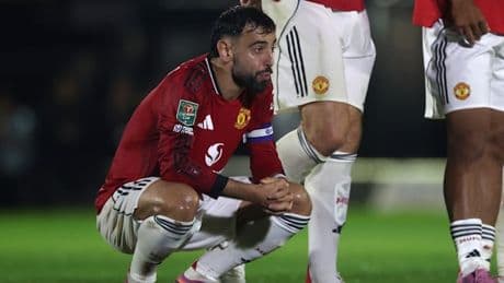 „Nicht für möglich gehaltener Tiefpunkt“ – Die Blamage von Manchester United