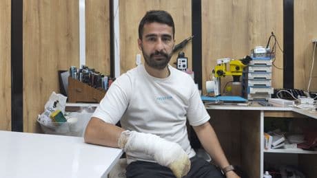Cep telefonu bataryası bomba gibi patladı! O anlar kamerada...