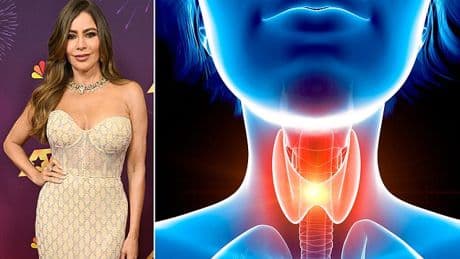The very common medical test that doctors now fear is behind the surge in thyroid cancer in young people... and why women are most at risk