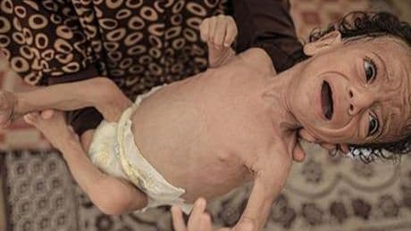 GAZZE'DE ANNELER SÜTTEN KESİLDİ, BEBEKLER ÖLÜMÜN EŞİĞİNDE: NE MAMA VAR NE TEMİZ SU!