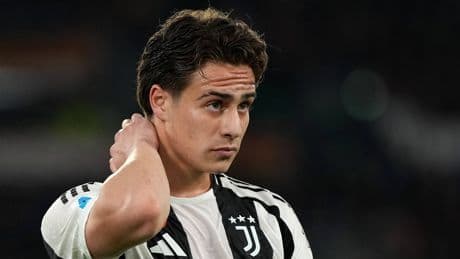 Juventus Udinese maçı, Kenan Yıldız ilk 11'de!