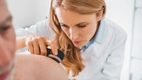 Los dermatólogos advierten de que una quemadura solar de niño duplica el riesgo de cáncer de piel de adulto