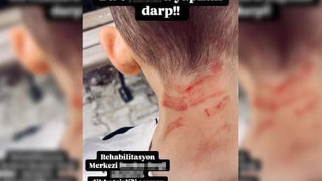 Rehabilitasyon merkezinde 5 yaşında çocuğa darp iddiası:  Adli ve idari soruşturma başlatıldı
