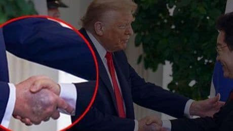 Trump'ın elindeki morluk hakkında Beyaz Saray'dan açıklama