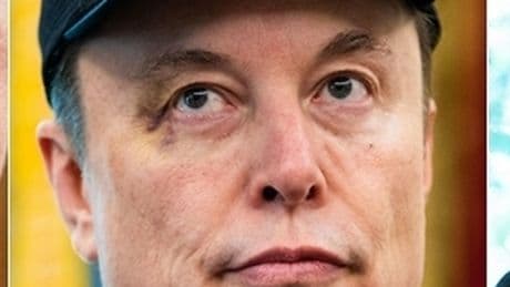 Elon Musk alla Casa Bianca con un occhio nero: «È stato mio figlio, gli ho detto di colpirmi e lo ha fatto»