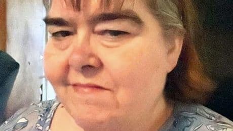 Mum 'neglected her son' so badly his legs rotted away and had to be amputated