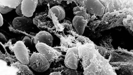 Hace 4.000 años, una misteriosa plaga se propagó por medio mundo: ya sabemos qué era y cómo lo hizo