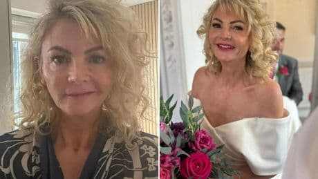I was so stressed after my dream £6k honeymoon cruise was cancelled my face COLLAPSED & was left PARALYSED