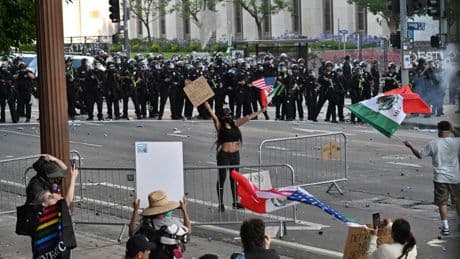 AFP photographer recovers after being shot in face with rubber bullet at LA protest