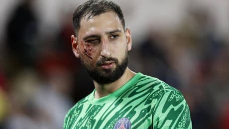 Quella cicatrice sul volto di Gigio che il PSG ha dimenticato troppo in fretta.