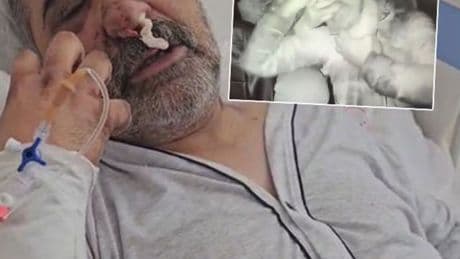 Taksici bayıltan şiddeti anlattı! "Gözlerimi oymaya çalıştı!"