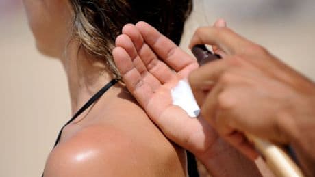 Wearing shorts and skirts or going without top ‘could affect skin cancer risk’