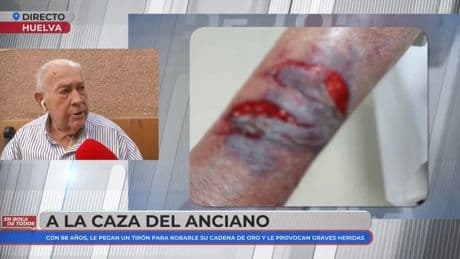 José, de 88 años, víctima de una brutal agresión: "Solo pido poder sentarme tranquilo en un banco"
