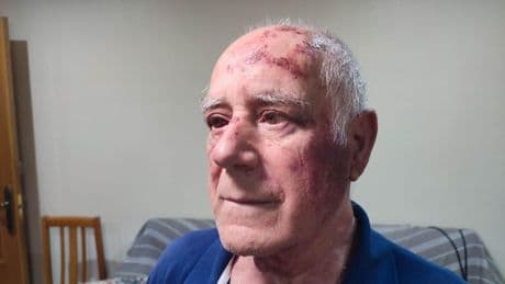Prisión sin fianza para el joven detenido en Rentería por la agresión al hombre de 68 años en Torre Pacheco