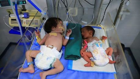 Starvation crisis caused by Israeli war and aid blockade kills at least 66 children in Gaza