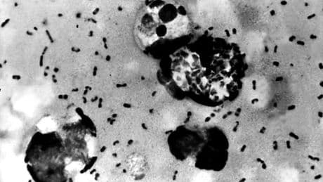 Arizona resident dies from the plague less than 24 hours after showing symptoms